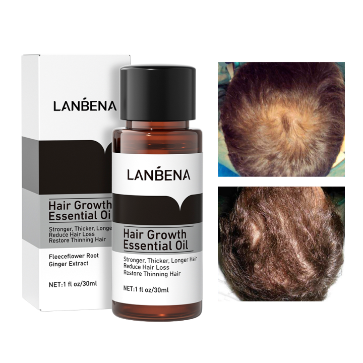 Welhair for Men  Hỗ trợ mọc tóc cho nam ngăn ngừa rụng tóc giúp tóc chắc  khỏe Hộp 30 viên  Lazadavn