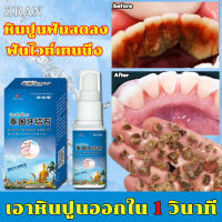 ⚡️เอาหินปูนออกใน 1 วินาที น้ำยากำจัดหินปูน30ML ขจัดคราบหินปูน น้ำยากำจัดหินปูน ยาสีฟันฟอกฟันขาว กําจัดนิ่วในฟัน ยาสีฟันฟันขาว ซ่อมฟันเหลือง ฟันขาวขึ้น น้ำยาขัดฟันขาว หินปูน Dental stone spray