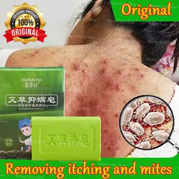 Sulfur Soap Mite Remover Soap Anti Fungal Scabies Acne Treatment Body  Lightening