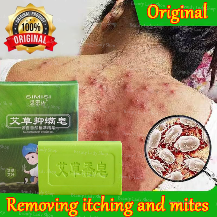 Herble Soap Eczema Skin Repair Acne Psoriasis Seborrhea Anti Fungus Sulfur Soap Bath Whitening