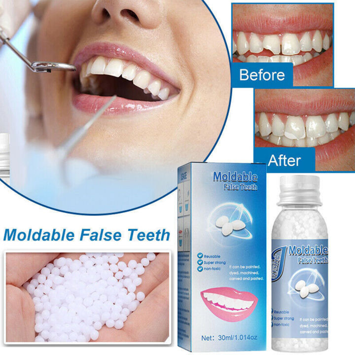 Tooth Filling Solid Gigi palsu Denture Material Temporary Tooth Repair ...