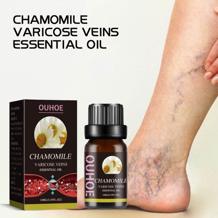 10ml Marronie Oil For Varicose Veins Marronie Chamomile Oil Varicose