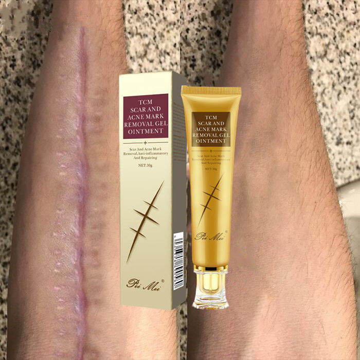 Scar care scar removal cream, Restore dark pitted scars, Burns, Fade