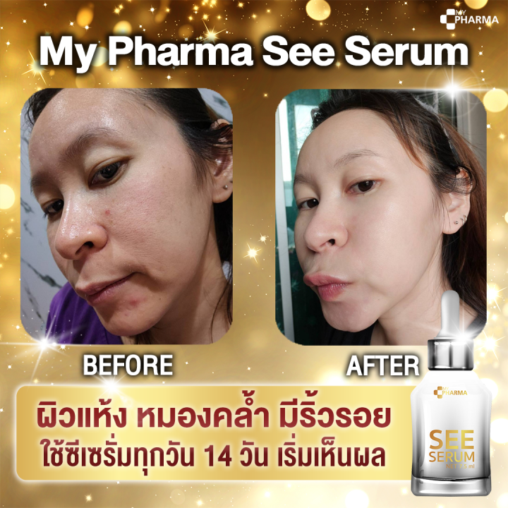 เซรั่มลดฝ้า-เซรั่มลดฝ้ากระ-เซรั่มลดฝ้ากระจุดด่างดำ-see-serum-แบรนด์-my-pharma-โปรสุดคุ้ม-ส่งฟรี