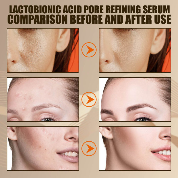 lactobionic-acid-pore-shrink-face-serum-hyaluronic-acid-moisturizing-nourish-smooth-pores-repair-essence-firm-เครื่องสำอางเกาหลี
