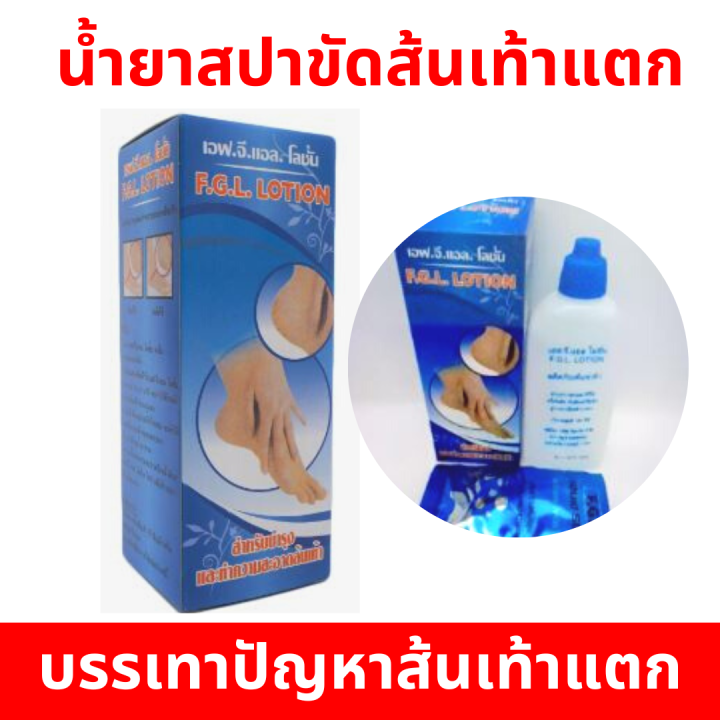 สุดคุ้ม-ชุดเซ็ต-5-ขวด-ใช้ได้นาน-น้ำยาขัดส้นเท้าแตก-ช่วยทำความสะอาด-ขจัดเซลล์ผิวเก่าให้หลุดลอกออก-ใช้งานง่าย-สะดวก