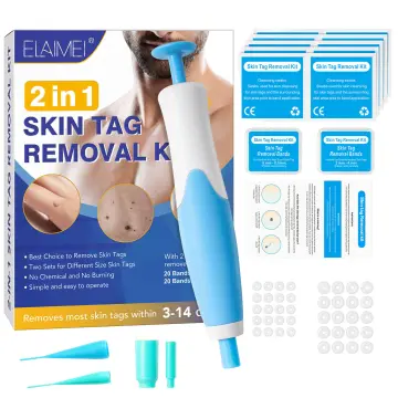 Skin Tag Remover Pen - Best Price in Singapore - Oct 2023