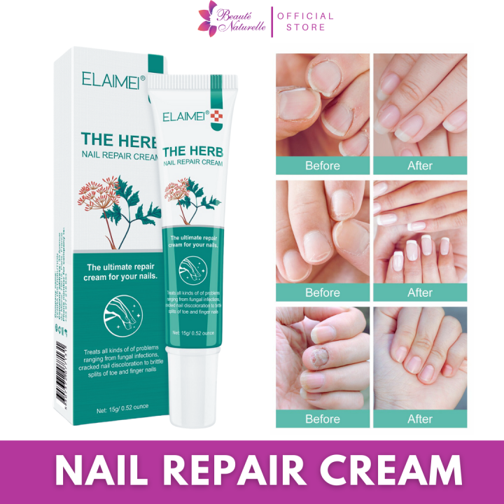 100 Effective The herb Nail Fungus repair treatment care cream essence