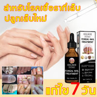 【ของแท้100%】เซรั่มซ่อมแซมเล็บ ซ่อมแซมเล็บเสีย ส่งเสริมการเจริญเติบโตของเล็บดีเยี่ยม ยากันเชื่อราเล็บ（น้ำยาฆ่าเชื้อราที่เล็บ ครีมบำรุงเล็บ น้ำมันบำรุงเล็บ ครีมเชื้อราที่เล็บ เซรั่มรักษาเล็บเชื้อรา ยาทาเชื้อราที่เล็บ น้ำยาใส่เล็บขบ ยาฆ่าเชื้อเล็บ）