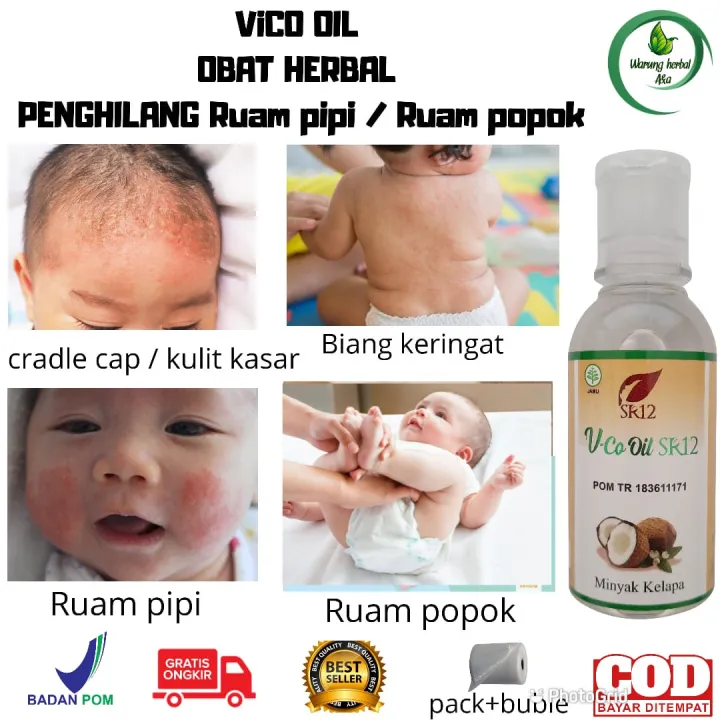 Sr12 Obat Kulit Bayi Obat Ruam Popok Bayi Obat Ruam Pipi Obat Ruam Merah Obat Herpes