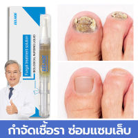 เล็บออกดอก Nail Repair Serum เซรั่มซ่อมแซมเล็บ ฆ่าเชื้อราเล็บ บำรุงเล็บเสีย บำรุงเล็บมือ ห่างกับปัญหาเล็บ ยากันเชื่อราเล็บ