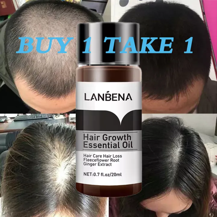 PURC New Fast Hair Growth Essencel Oil Prevent Hair Loss 20ml And PURC Magical Treatment Mask Hair Care|Hair Loss Products| AliExpress | Fast Delivery New Fast Hair Growth Essencel Oil Prevent Hair PURC New Fast Hair Growth Essencel Oil Prevent Hair Loss 20ml And PURC Magical Treatment Mask Hair Care|Hair Loss Products| AliExpress | Fast Delivery New Fast Hair Growth Essencel Oil Prevent Hair