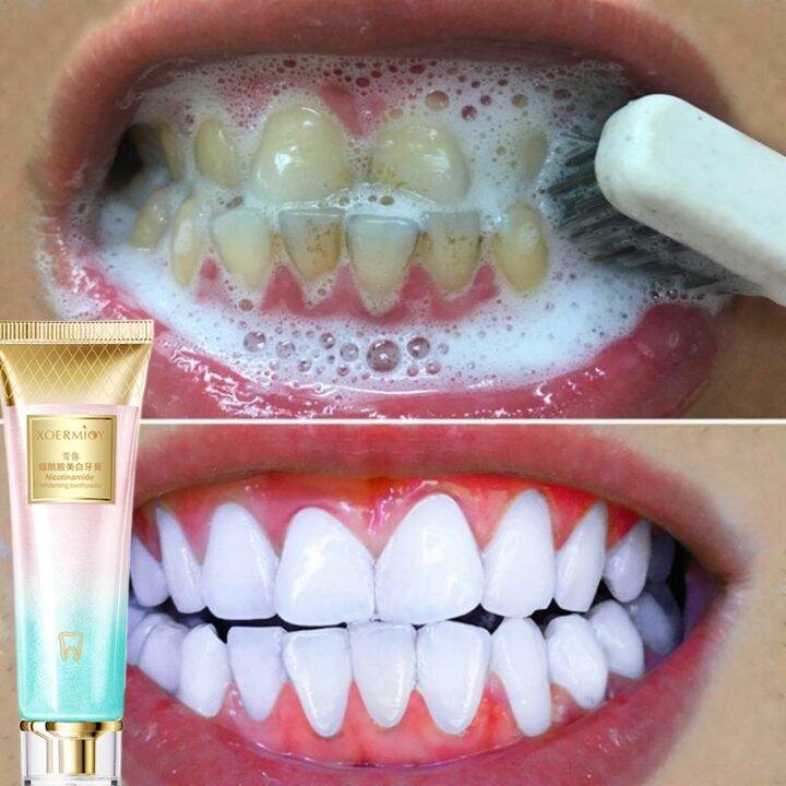 清新口气去牙结石cleaning Teeth Whitening Mousse Foam Toothpaste Oral Hygiene Effective Remove Tooth 1342