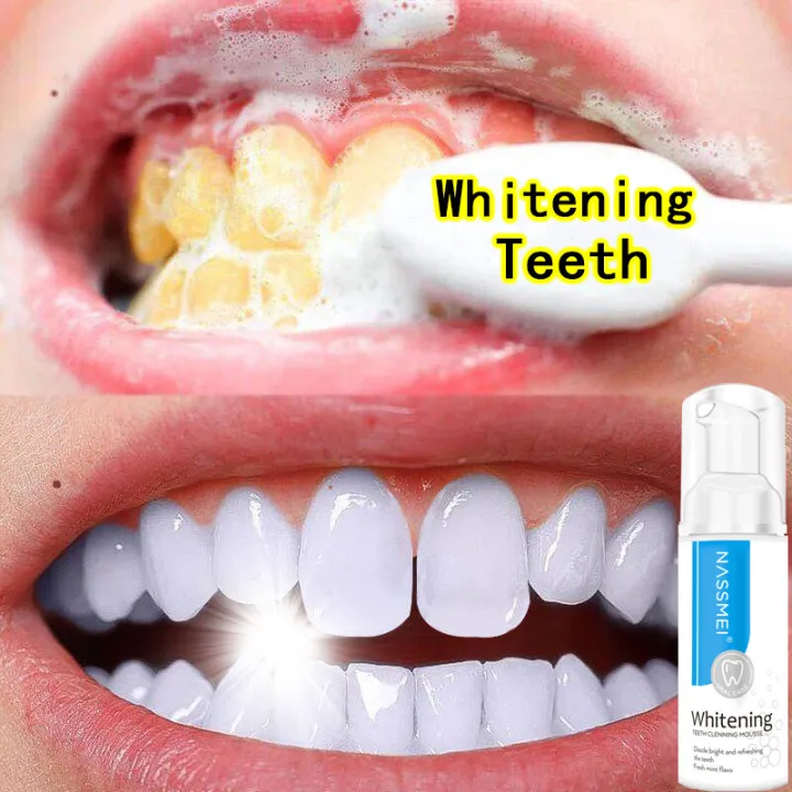 Whitening teeth Teeth Whitening Black Toothpaste Whitening Smokers