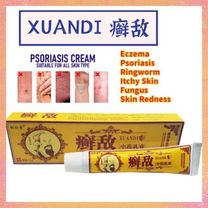 Xuandi Psoriasis Eczema Ezema Itchy Anti Fungal Cream Treatment Krim
