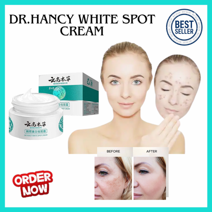 TOP SELLING DR. HANCY White Spot Cream Japanese Melasma Cream 20g ...