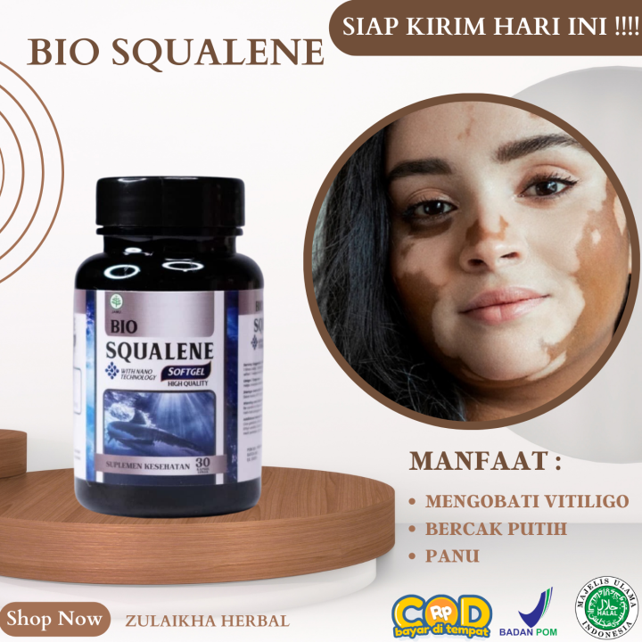 Obat Vitiligo Original, Obat Vitiligo Di Muka, Obat Vitiligo Herbal ...