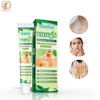 【Ready Stock】Vitiligo Leukoplakia Disease Treatment Ointment White Spot Disease Repair Cream Pigment Melanin Balm