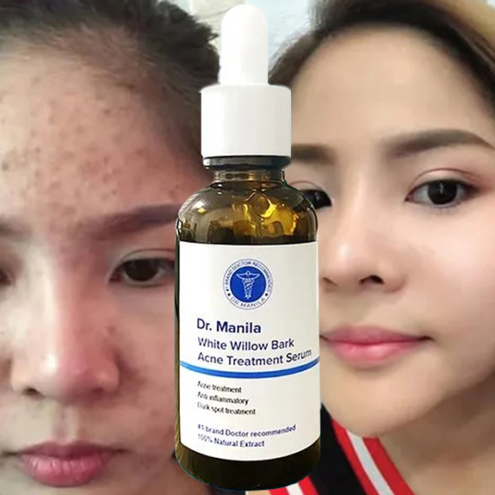 Dr.Manila - Acne Treatment Serum White Willow Bark | Lazada PH