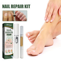 South Moon Toenail Repair Set Hand And Foot Thickening Cleaning Bright Nail Gray Nail Dust Repair Set