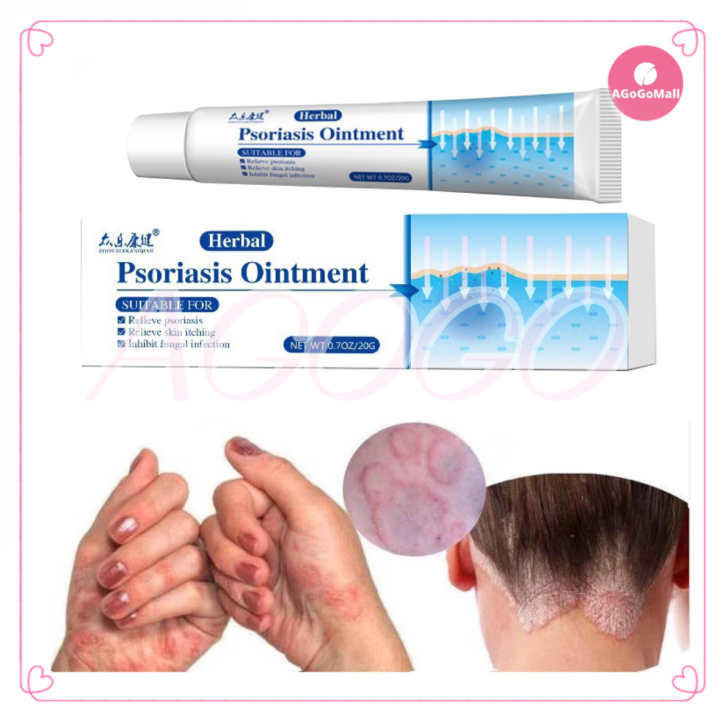 Original Authentic Eczema Cream Psoriasis Dermatitis Ointment Health Itching Relief Skin