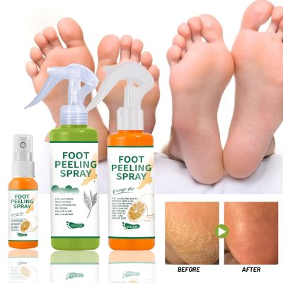 【CW】 Foot Exfoliator Softener Remove Dead Skin Calluses Mask Anti Cracked Heel Enhancer Nail Pedicure Elbow Knee Exfoliation