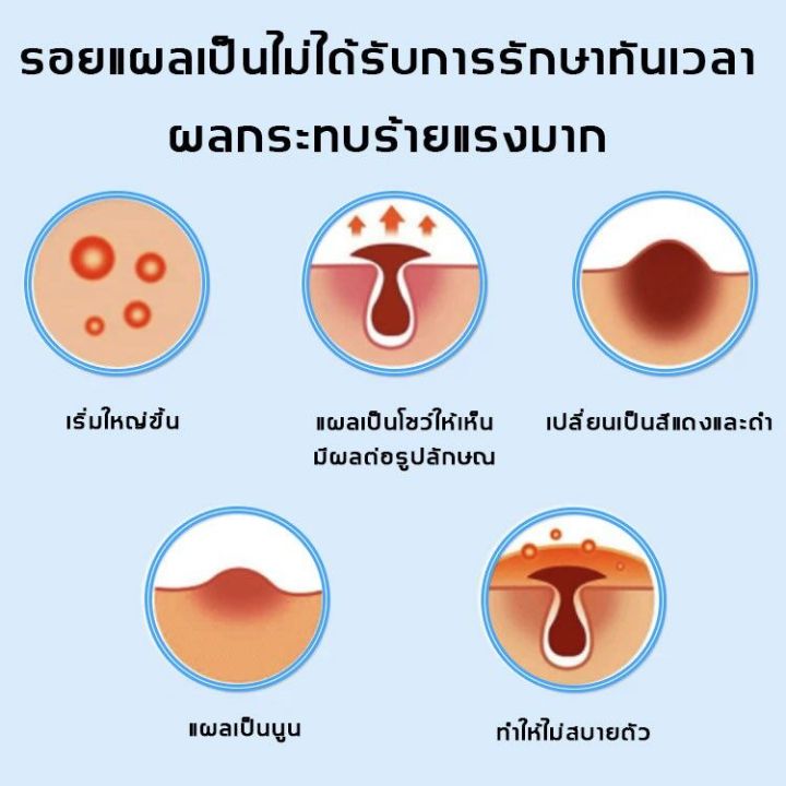 เห็นผลใน3วัน-รอยแผล-ครีมลบแผลเป็น-ลบรอยแผลถาวร-ลดรอยสิว-รอยดำ-ครีมลดรอยแผลเป็น-ลดแผลไฟไหม้-แผลน้ำร้อนลวก-แผลผ่าตัดเป็นต้น-แผลเป็นหลายประเภท-ยาทาแผลเป็น-ครีมทาแผลผ่าคลอด-รีมทาแผลเป็น