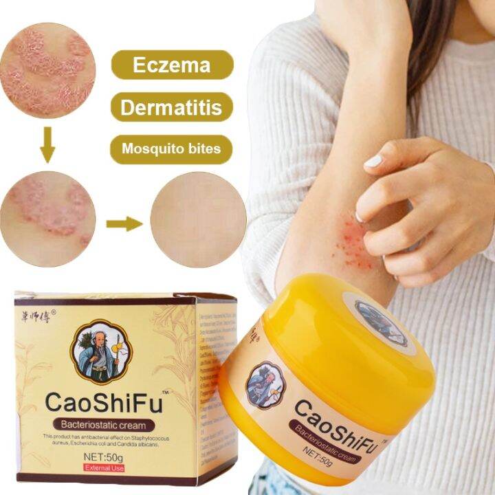 Caoshifu 50g Eczema Treatment Ointment Antibacterial Psoriasis Cream Herbal Itching Skin Care 3654