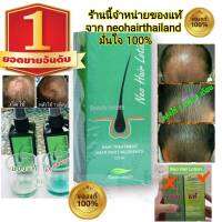 แบรนด์แท้ศูนย์ 100% Neo Hair Lotion ส่งด่วนทุกวัน นีโอแฮร์โลชั่น นีโอแฮร์ เซรั่มบำรุงผม ปลูกผม เร่งผมยาว