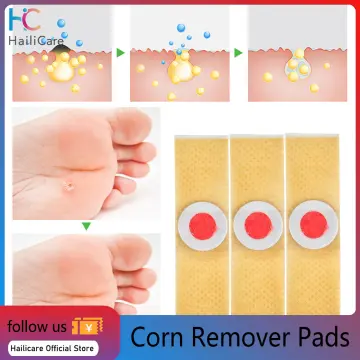 Corn Remover Cream,10ml Foot Toes Corn Callus Removal Cream Pad