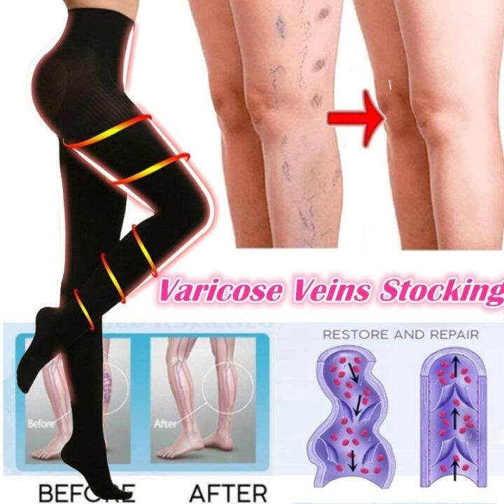 Breathable Compression Pressure Shaping Stockings Leggings Varicose