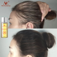 MeiYanQiong tinh dầu lỏng điều ngăn ngừa rụng tóc tăng trưởng tóc nhanh thumbnail