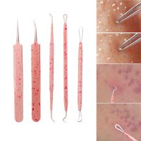 【LZ】❣☾✿  1Pc Blackhead Removal Needles Black Dots Cleaner Stainless Steel Spot Extractor Acne Treatment Needle Face Clean Care Tools