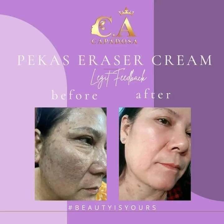 CAPADOSA PEKAS ERASER CREAM Lazada PH