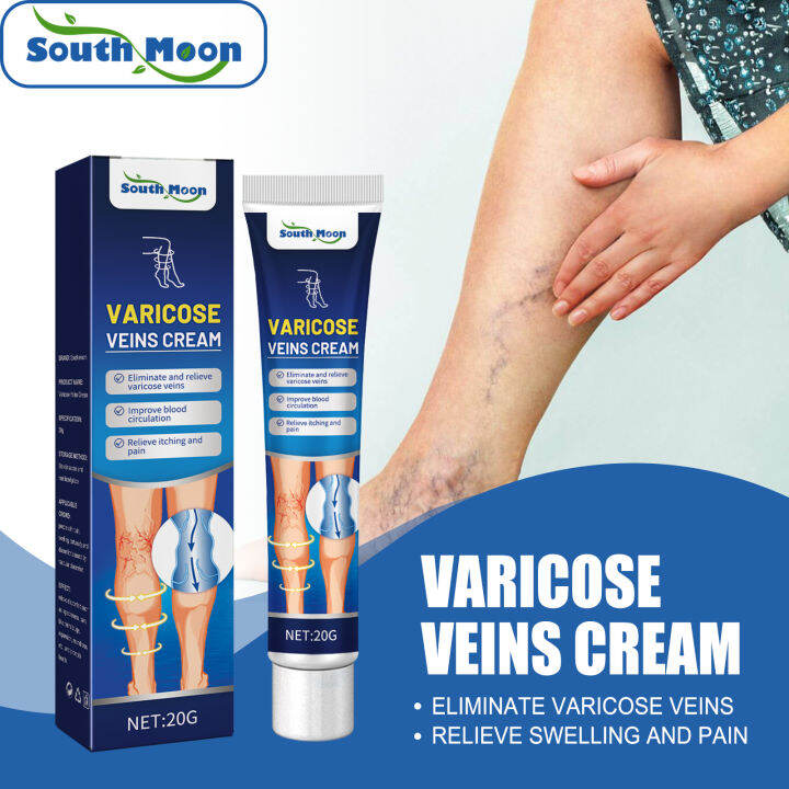 South Moon Varicose Veins Cream Eliminate Relieve Varicose Veins Cream ...