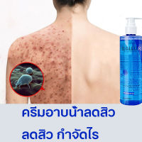 Body wash  ครีมอาบน้ำ  ครีมอาบน้ำลดสิว 260ml  ต่อต้านเชื้อราแก้คัน  ให้ความชุ่มชื้นอ่อนโยน  กลิ่นหอมติดทน  ลดสิว  กำจัดไร  คุมน้ำมัน