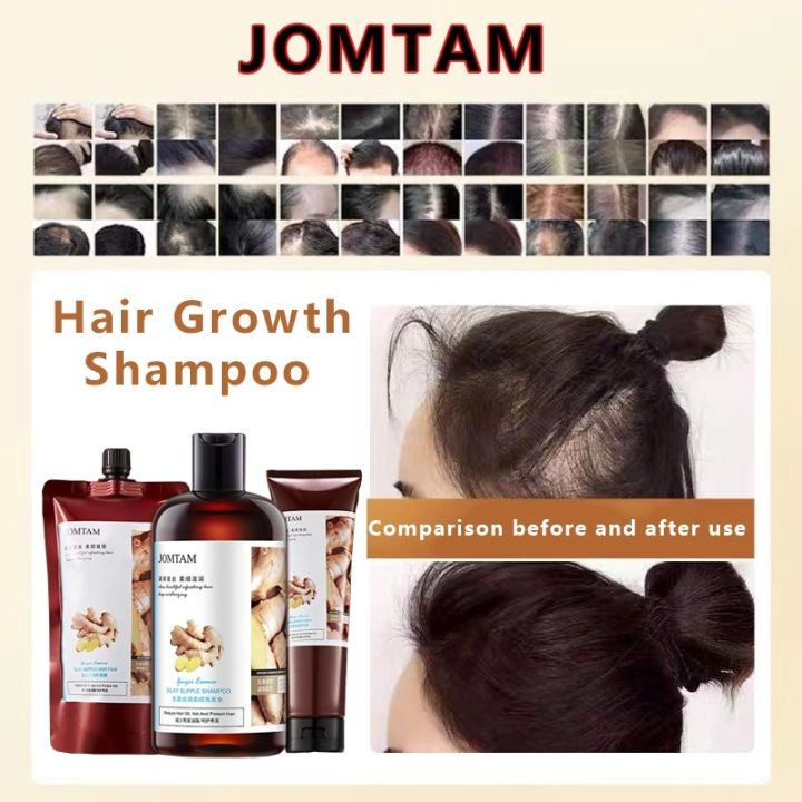 Treat Dandruff with Minoxidil Conditioner Shampoo Ginger Hair Growth ...