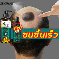 【มีสินค้าพร้อมจัดส่ง】【2 ขวด 】ZENSHOW แชมพูแก้ผมร่วง 500+30ml (ยาปลูกผมหญิง แซมพูเร่งผมยาว ผมบาง ปลูกผม น้ำยาเร่งผมยาว ทรีทเม้นท์ผม ยาแก้ผมร่วงบาง แชมพูเร่งผม×10 ซรั่มปลูกผม ดูแลผม ป้องกันผมร่วง เซรั่มบำรุงผม เซรั่มใส่ผม เจริญเติบโตของเส้นผม)