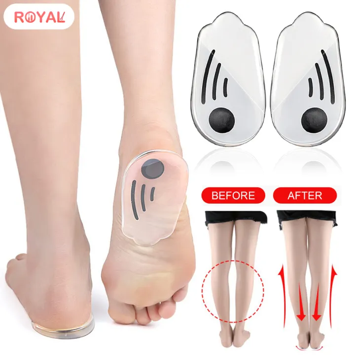 Royal Orthopedic Shoe Inserts with Magnets Stone for O/X Type Leg ...