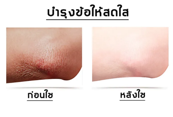 billbill-สบู่ลูกพีช-pp-สบู่ก้นใต้วงแขนทั้งตัวสีดำลดเลือนริ้วรอยสบู่แฮนด์เมดสบู่สวยหลังสวยสบู่สบู่