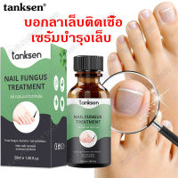 บอกลาเชื้อราที่เล็บเท้า tanksenเซรั่มบำรุงเล็บ30ml เชื้อราเล็บมือ เชื้อราเล็บ บำรุงเล็บ ครีมบำรุงเล็บ ช่วยให้เล็บกลับมาแข็งแรง ป้องกันเล็บเปลี่ยนสี เซรั่มซ่อมแซมเล็บ น้ำมันบำรุงเล็บ แก้เชื้อราที่เล็บ ดูแลเล็บ ออยบำรุงเล็บ น้ำยาบำรุงเล็บNail Repair Essence