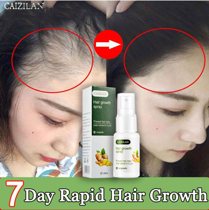 CAIZILAN Hair Growth Spray Speed Up Hair Growth Prevent Hair Loss