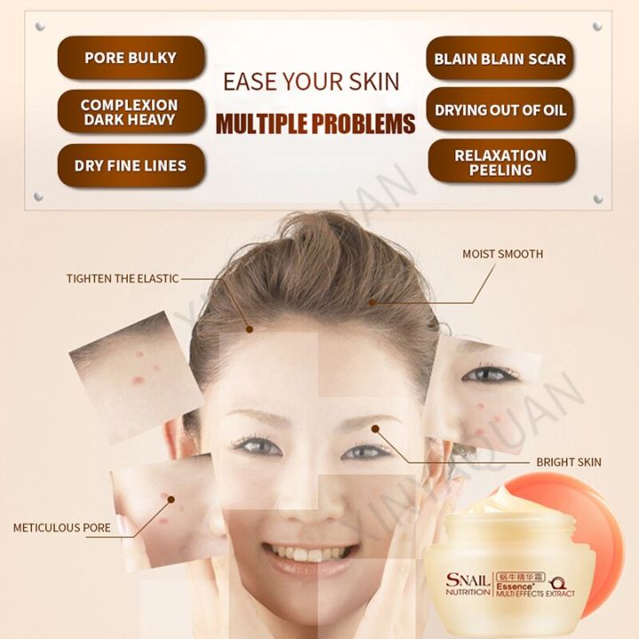 ครีมบำรุงผิวหน้าสูตรหอยทาก-snail-white-cream-anti-aging-acne-anti-wrinkle-day-50g