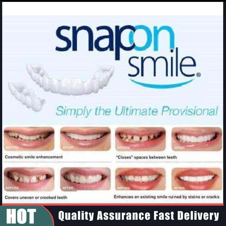 Snapon Smile Teeth Veneer | Lazada PH