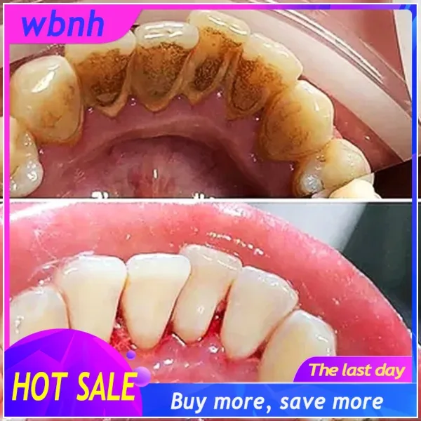 Whitening Toothpaste clean teeth tartar Liquid Remove tooth stains10ml