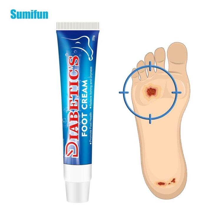 1pc Diabetes Foot Cream Bacteriostasis Treatment Skin Itchy Anti Fungal
