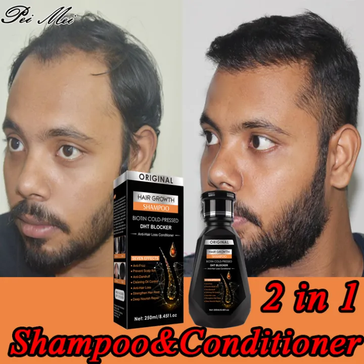 Delivery in 3 day】PEIMEI Hair Growth Shampoo hair grower shampoo Shampoo For All Types Of Delivery in 3 day】PEIMEI Hair Growth Shampoo hair grower shampoo Shampoo For All Types Of