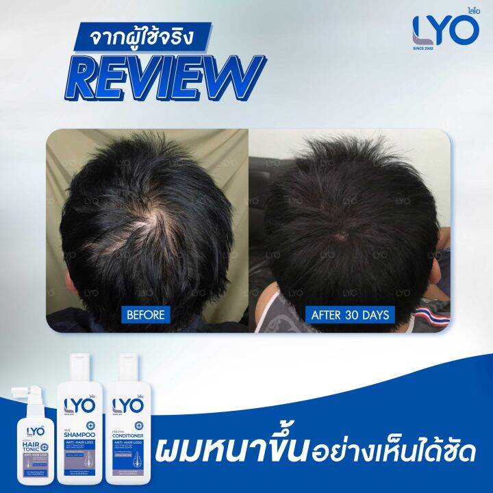 โปร2ขวด-ไลโอ-แฮร์โทนิค-เซรั่มผม-ลดผมร่วง-ผมหนา-lyo-hair-tonic-30-ml