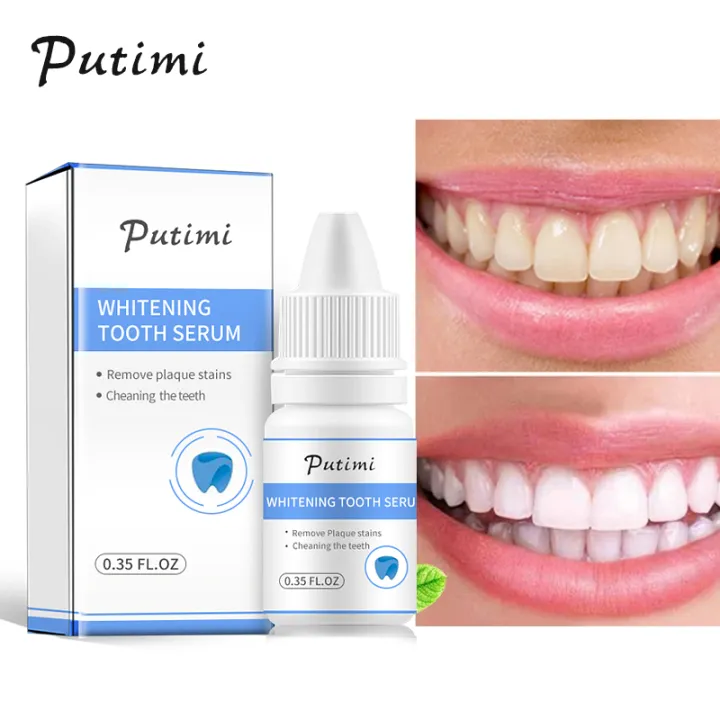 Putimi teeth whitening Clearance