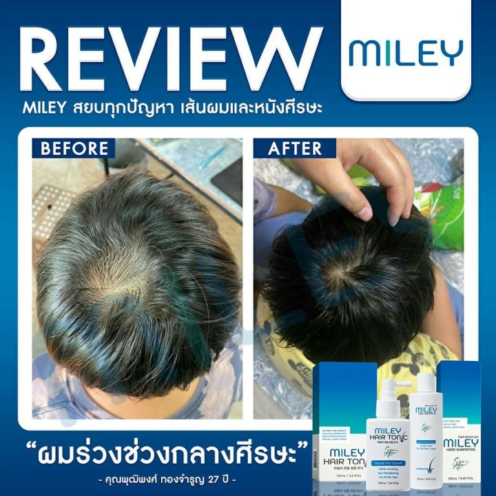 โปรพิเศษ-2แถม2-แชมพูลดผมร่วง-มิลเล่-แฮร์-แชมพู-miley-hair-shampoo-ผลิตภัณฑ์ดูแลเส้นผม-จากเกาหลี
